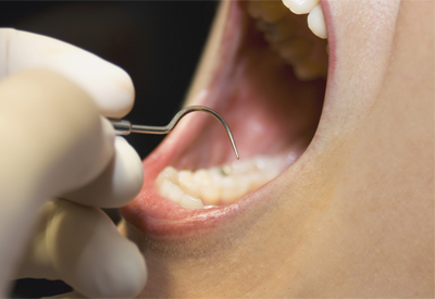 Dangers of Gum Disease Manassas, VA